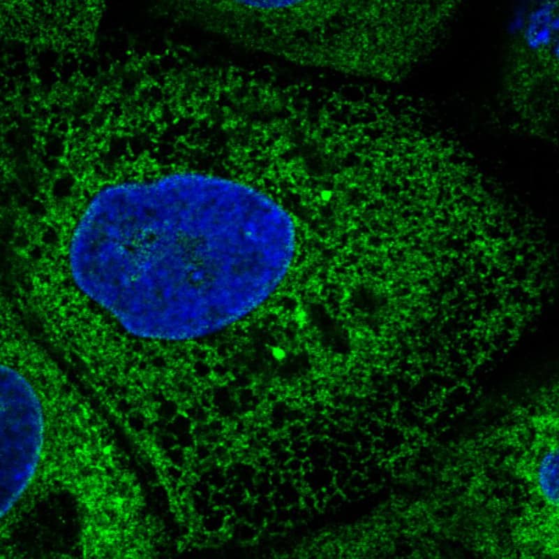 Staining in A431 cell line  showing specific staining of endoplasmic reticulum in green. Microtubule- and nuclear probes are visualized in red and blue respectively (where available).
