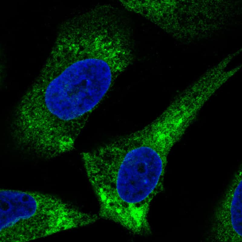 Staining in U251 cell line  showing specific staining of endoplasmic reticulum in green. Microtubule- and nuclear probes are visualized in red and blue respectively (where available).