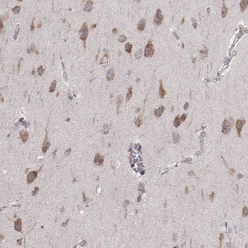 Staining of human cerebral cortex shows moderate cytoplasmic positivity in neurons.