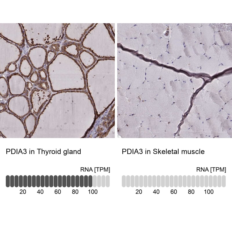 Analysis in human thyroid gland and skeletal muscle tissues. Corresponding ERp57/PDIA3 RNA-seq data are presented for the same tissues.