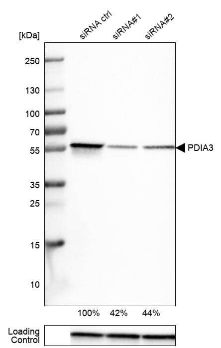Analysis in U-251MG cells transfected with control siRNA, target specific siRNA probe #1 and #2,. Remaining relative intensity is presented. Loading control: Anti-GAPDH.