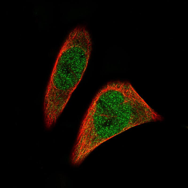 Staining of RH-30 cells, showing specific staining in the nucleus and cytosol in green. Microtubule- and nuclear probes are visualized in red and blue, respectively (where available).
