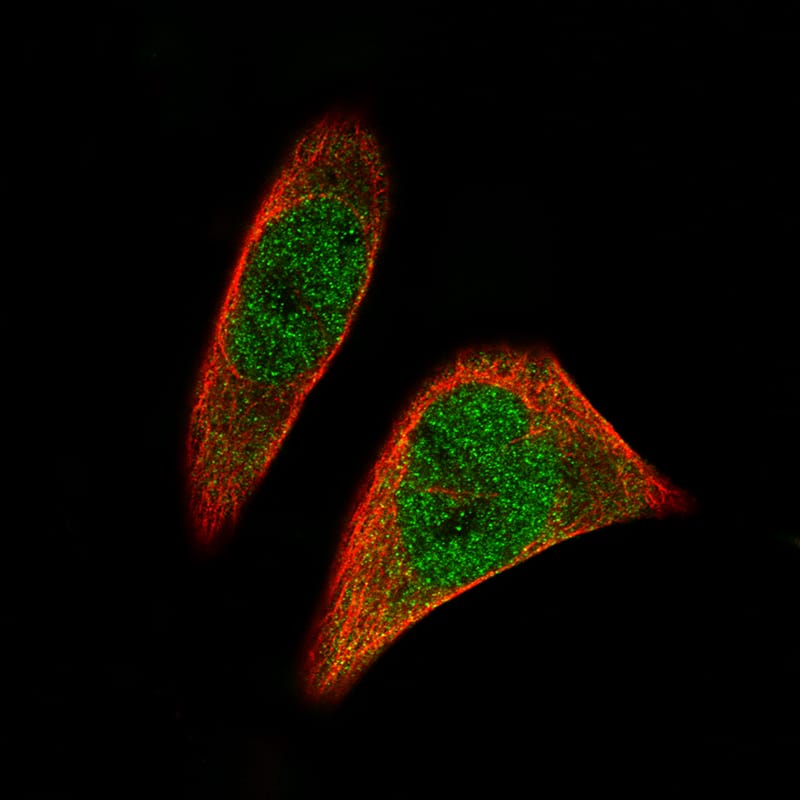 Staining of RH-30 cells showing specific staining in the nucleus and cytosol in green. Microtubule- and nuclear probes are visualized in red and blue, respectively (where available).