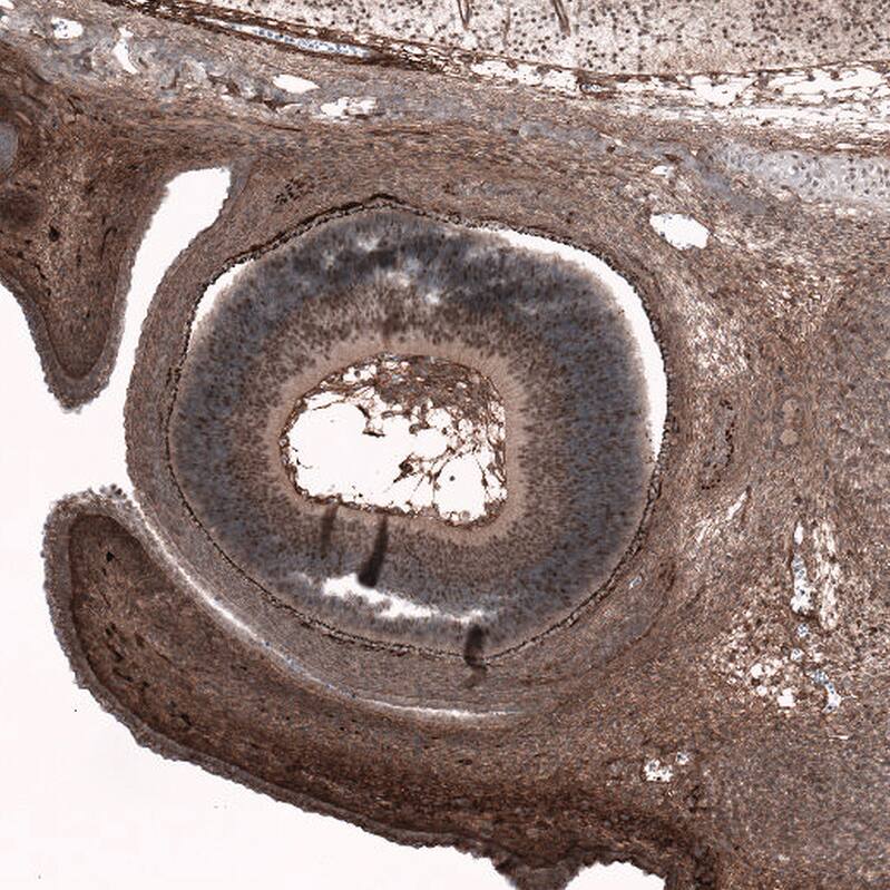 Staining of eye in mouse embryo E14  retina shows moderate nuclear positivity in developing retina.