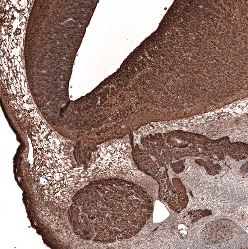 Staining of mouse embryo E11 shows strong positivity in the developing central and peripheral nervous system.
