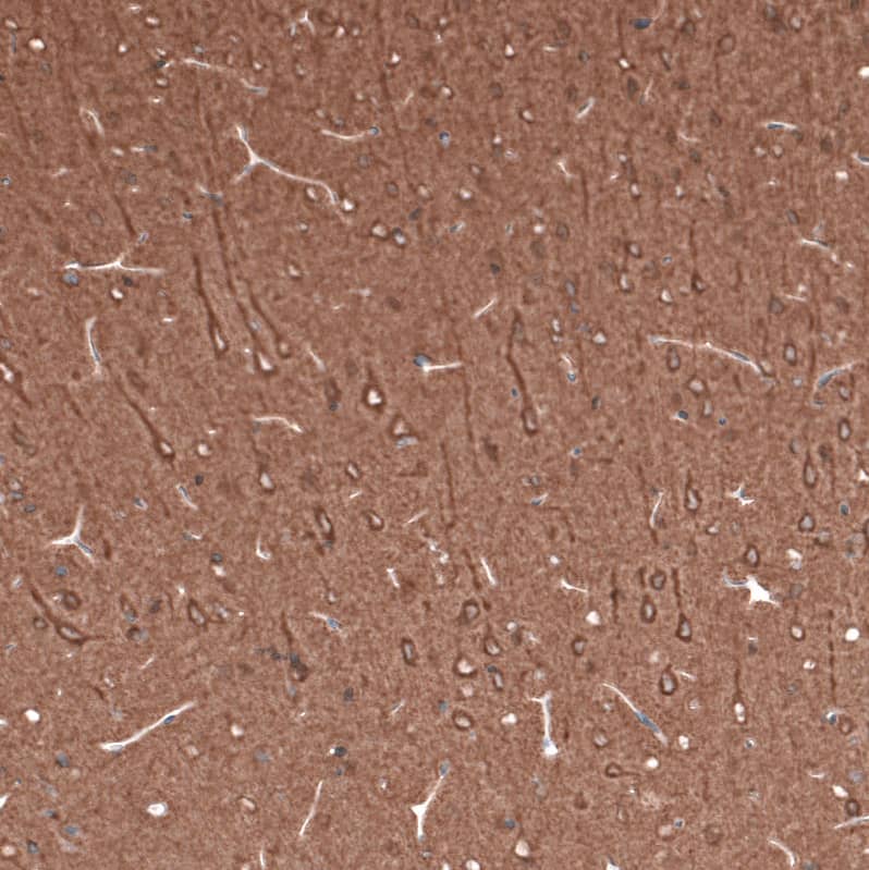 Staining of rat brain shows strong cytoplasmic positivity in neurons.