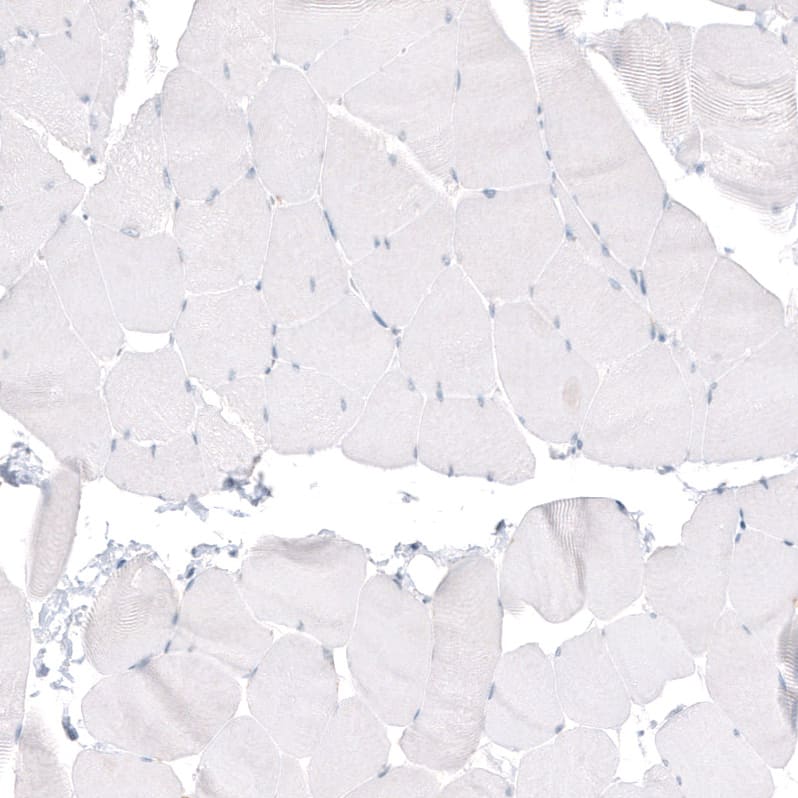 Staining of human skeletal muscle shows no positivity in myocytes as expected.