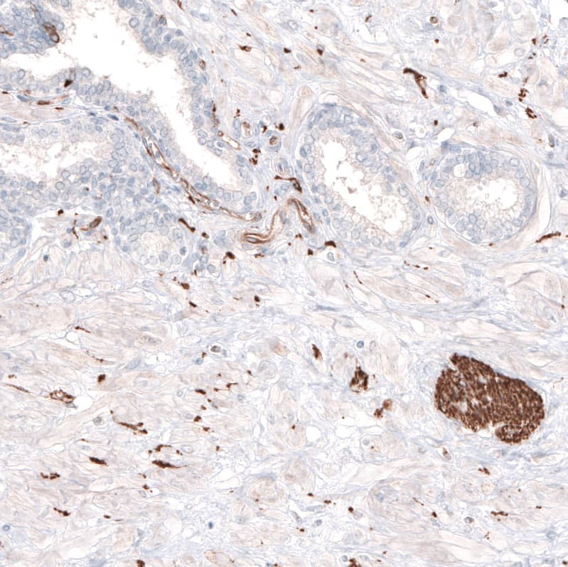 Staining of human prostate shows strong positivity in peripheral nerves.
