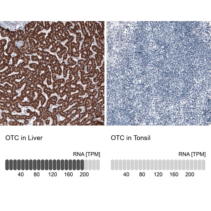 Analysis in human liver and tonsil tissues. Corresponding Ornithine Carbamoyltransferase RNA-seq data are presented for the same tissues.