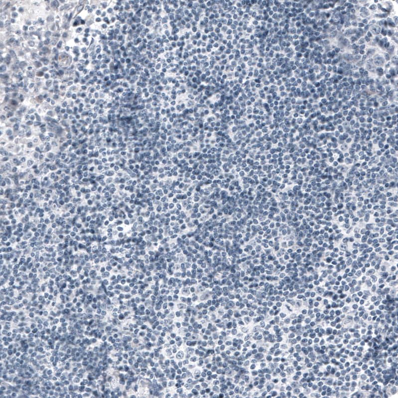 Staining of human tonsil shows no positivity in lymphoid cells as expected.