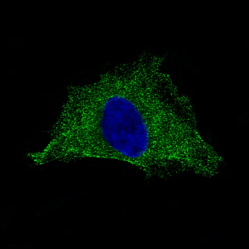 Staining of HeLa cells showing specific staining in the cytosol and plasma membrane in green. Microtubule- and nuclear probes are visualized in red and blue, respectively (where available).