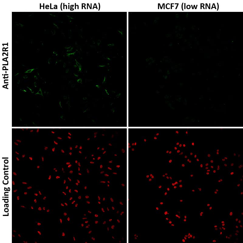 Staining of Hela and MCF7 exhibiting a relatively high and low expression of PLA2R1 (based on RNA-seq values), respectively. The PLA2R1 (green signal) is present in Hela cells but is absent in MCF7 cells. 