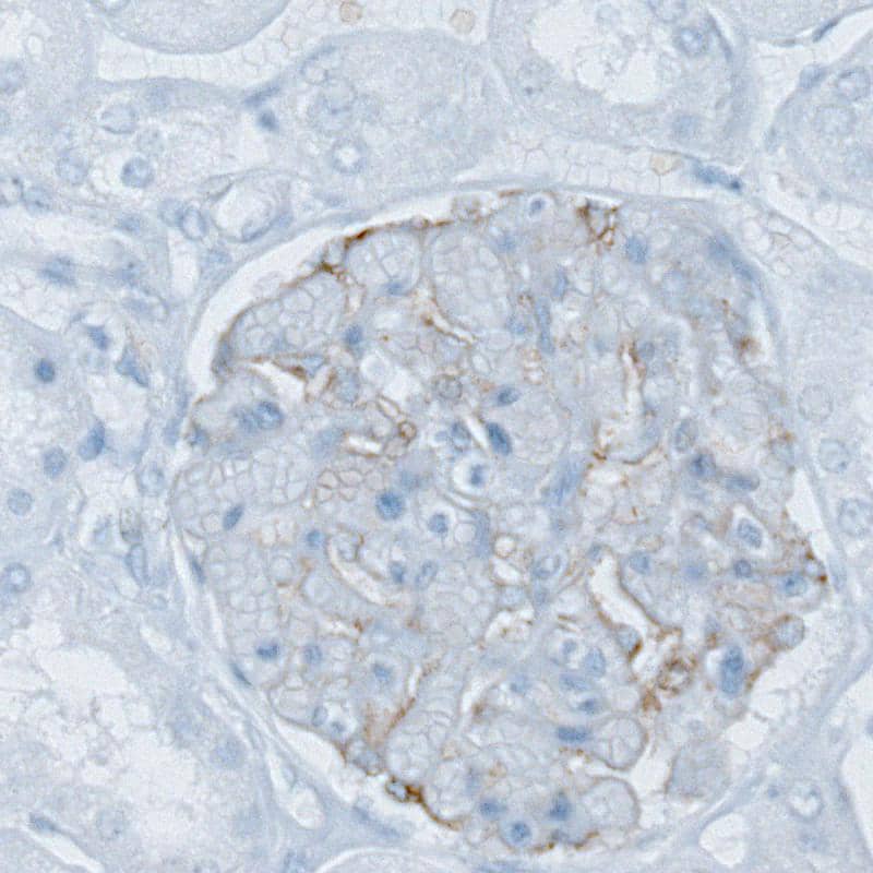 Staining of human kidney shows weak membranous positivity in cells in glomeruli.