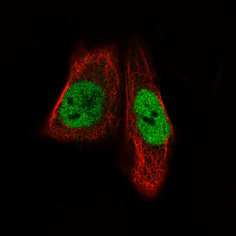 Staining of RH-30 cells, showing specific staining in the nucleoplasm in green. Microtubule- and nuclear probes are visualized in red and blue, respectively (where available).