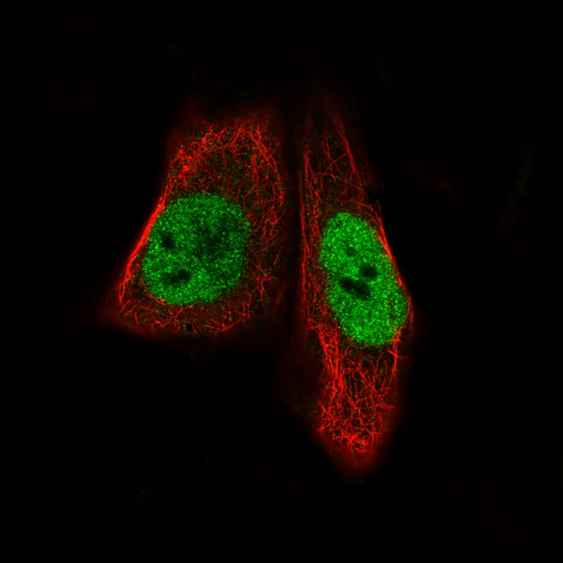 Staining of RH-30 cells showing specific staining in the nucleoplasm in green. Microtubule- and nuclear probes are visualized in red and blue, respectively (where available).