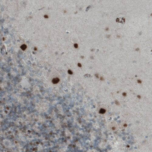 Staining of human cerebellum shows strong nuclear positivity in Purkinje cells.
