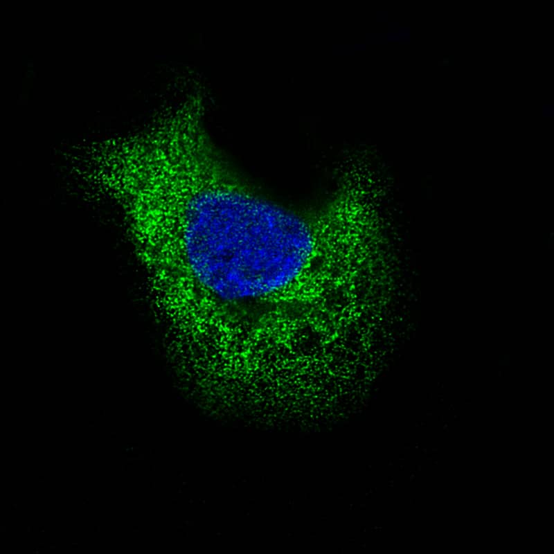 Staining of A-431 cells showing specific staining in the endoplasmic reticulum in green. Microtubule- and nuclear probes are visualized in red and blue, respectively (where available).