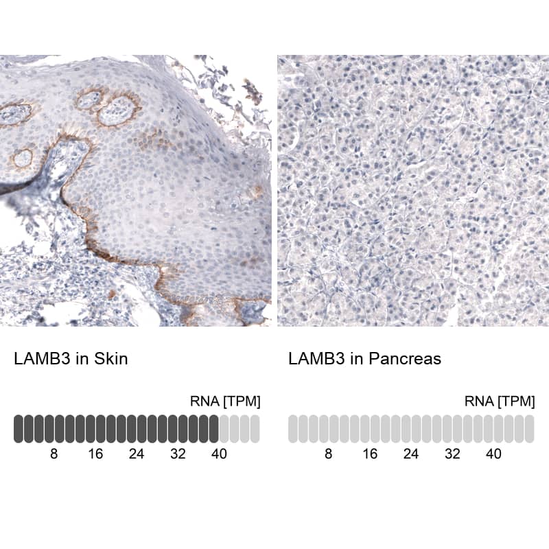 Analysis in human skin and pancreas tissues. Corresponding Laminin beta 3 RNA-seq data are presented for the same tissues.
