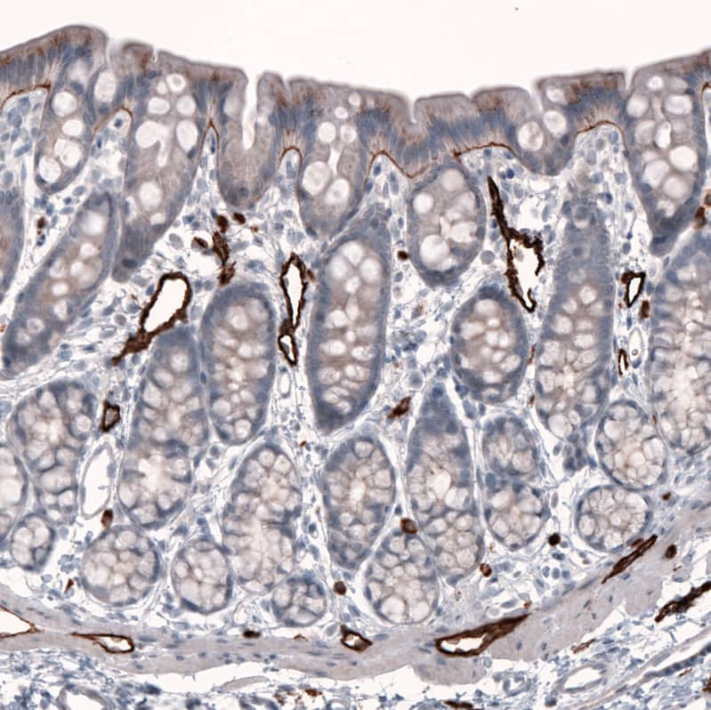 Staining of rat rectum shows moderate positivity in basement membrane of glandular cells, as well as strong positivity in endothelial cells.