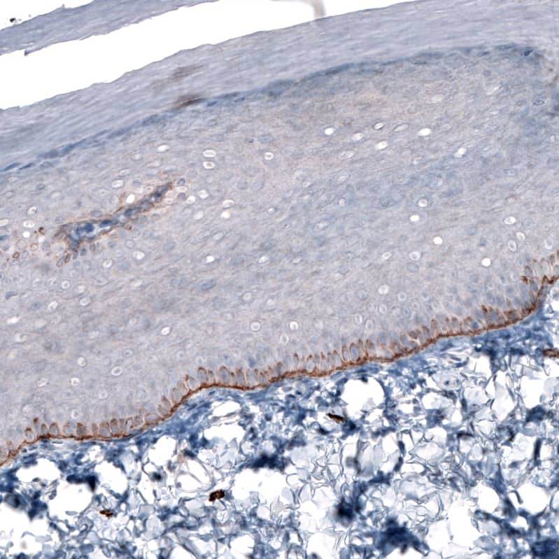 Staining of rat skin shows moderate to strong positivity in basement membrane basal epidermal cells.