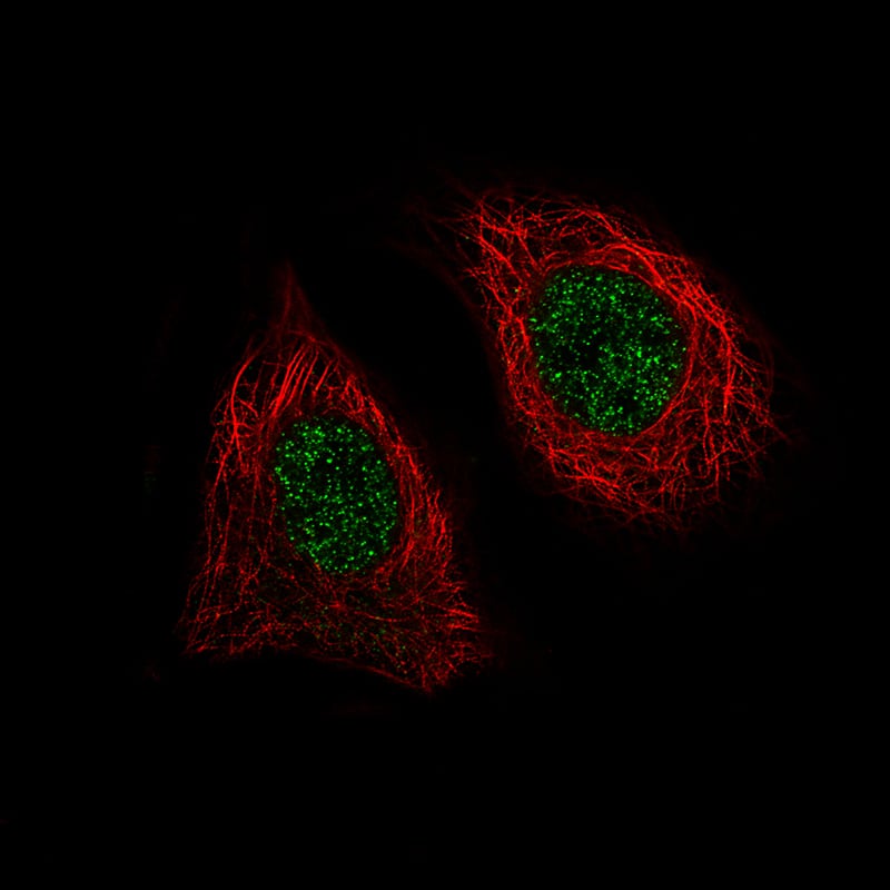 Staining of MCF-7 cells showing specific staining in the nucleoplasm in green. Microtubule- and nuclear probes are visualized in red and blue, respectively (where available).