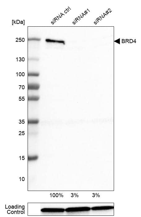 Analysis in U-251MG cells transfected with control siRNA, target specific siRNA probe #1 and #2,. Remaining relative intensity is presented. Loading control: Anti-GAPDH.