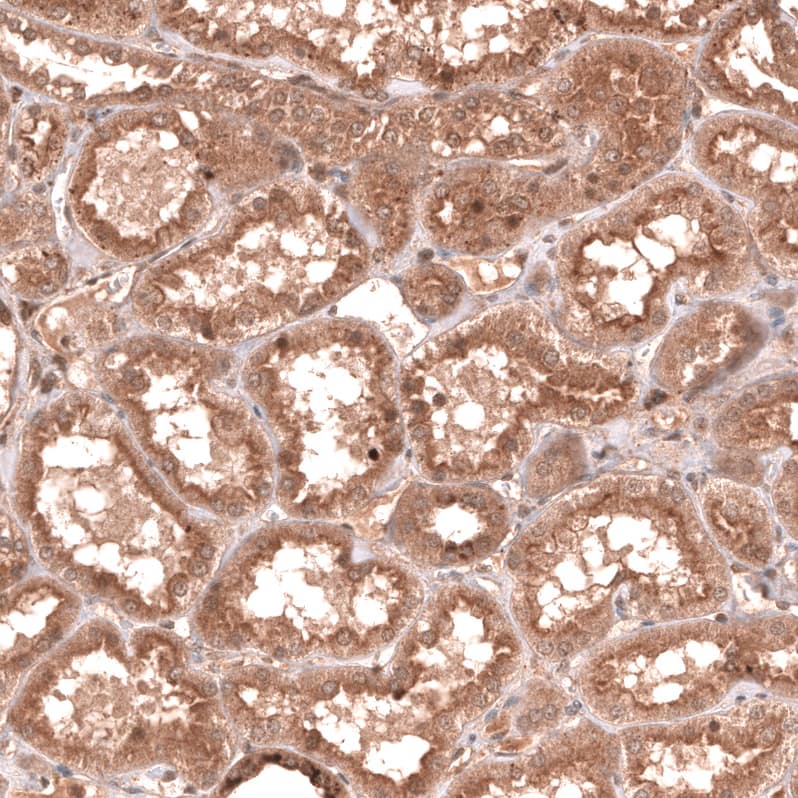 Staining of human kidney shows moderate cytoplasmic positivity in cells in tubules.
