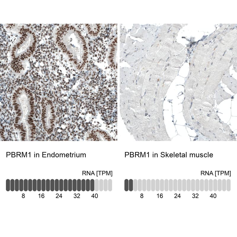 Analysis in human endometrium and skeletal muscle tissues. Corresponding BAF180/PB1 RNA-seq data are presented for the same tissues.