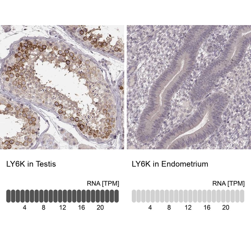Analysis in human testis and endometrium tissues. Corresponding Ly6K RNA-seq data are presented for the same tissues.