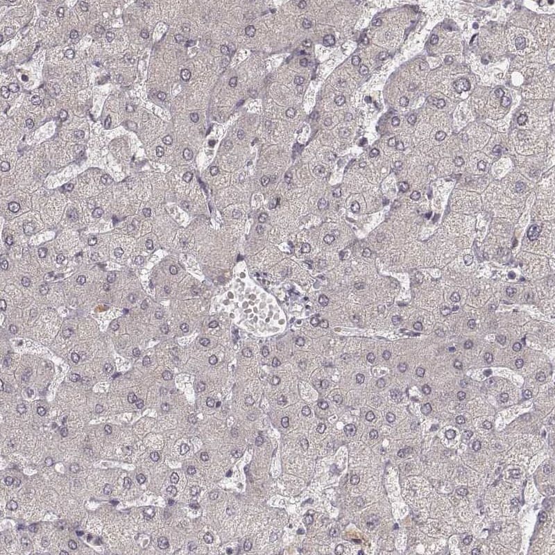 Staining of human liver shows no positivity in hepatocytes as expected.