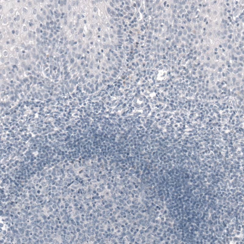 Staining of human tonsil shows absence of immunoreactivity as expected (negative control).
