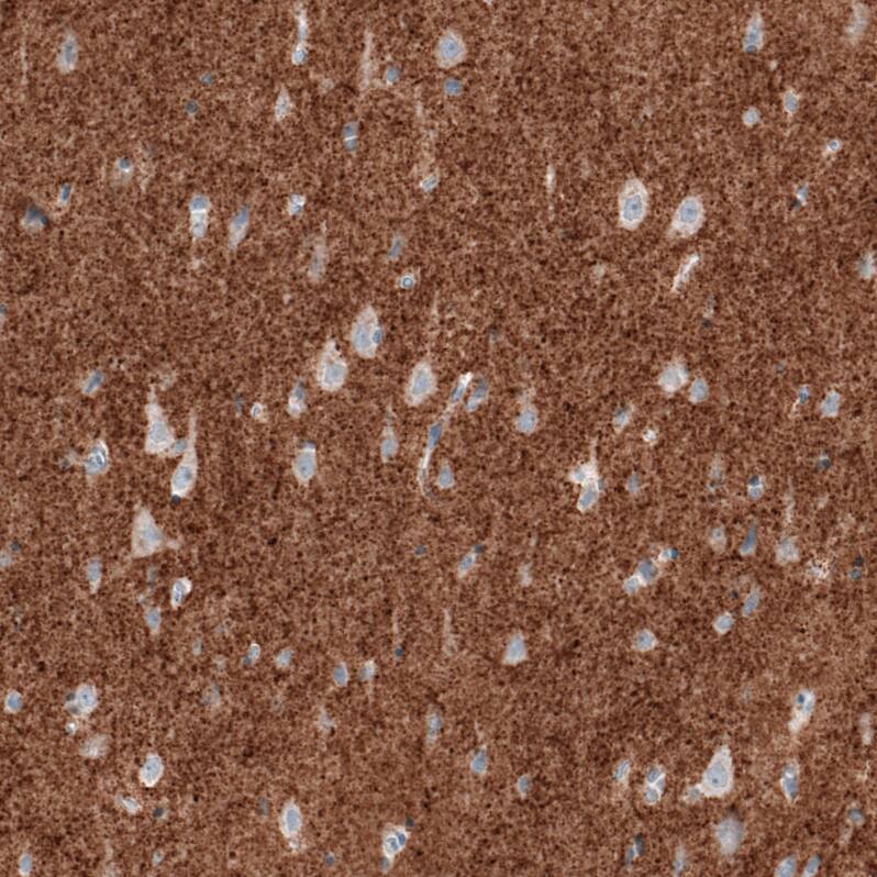 Staining of human cerebral cortex shows strong positivity in neuropil.