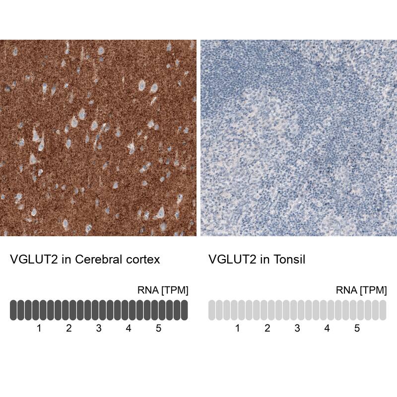 Analysis in human cerebral cortex and tonsil tissues. Corresponding VGLUT2 RNA-seq data are presented for the same tissues.
