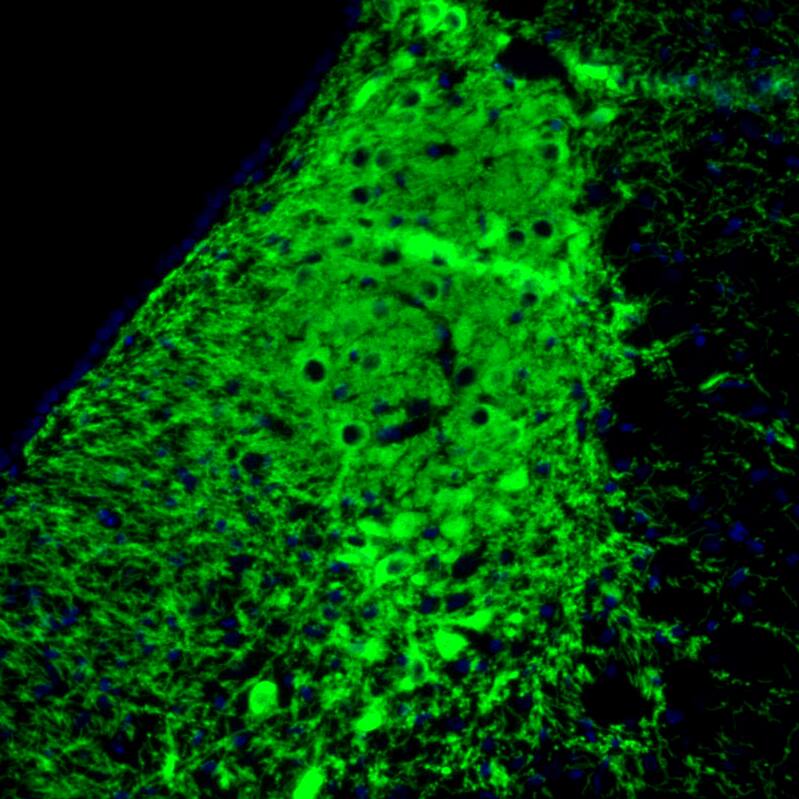 Staining of rat pons shows strong positivity in noradrenaline neurons in the locus coeruleus.