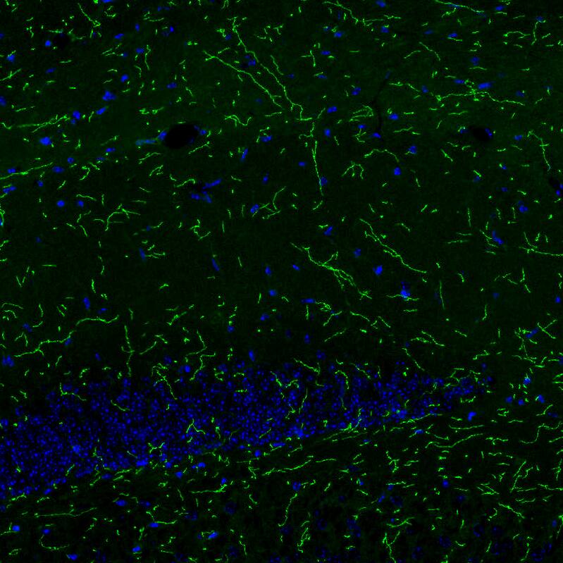 Staining of mouse brain shows strong positivity in noradrenergic fibers in the hippocampus.