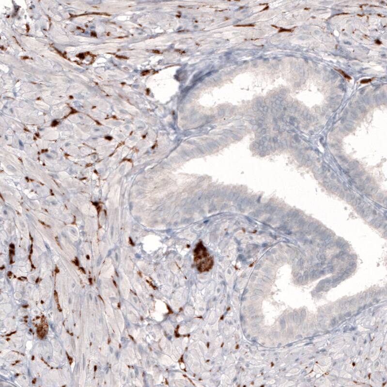 Staining of human prostate shows strong positivity in sympathetic peripheral nerves.