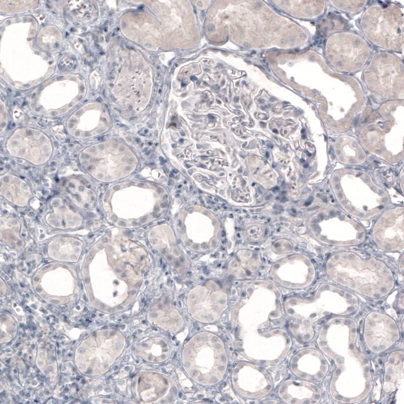 Staining of human kidney shows no positivity in cells in tubules or glomeruli as expected.