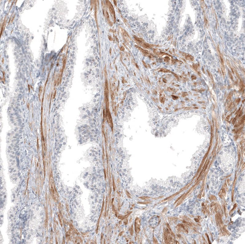 Staining of human prostate shows moderate cytoplasmic positivity in smooth muscle cells.