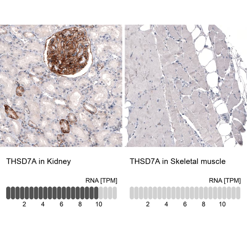Analysis in human kidney and skeletal muscle tissues. Corresponding THSD7A RNA-seq data are presented for the same tissues.