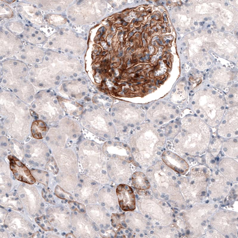 Staining of human kidney shows strong membranous positivity in cells in glomeruli, as well as in a subset of renal tubules.