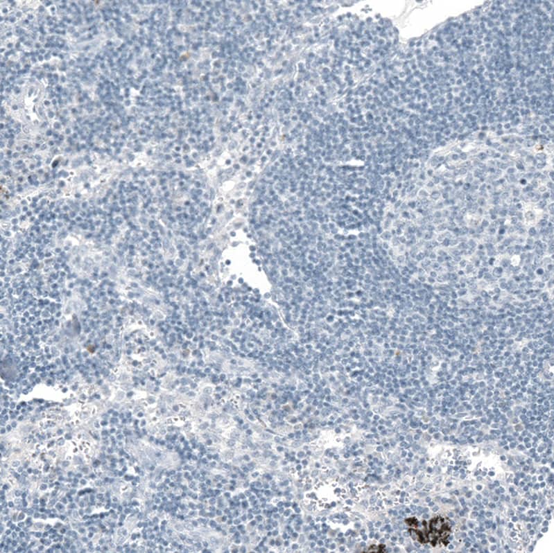 Staining of human lymph node shows no positivity in lymphoid cells as expected.