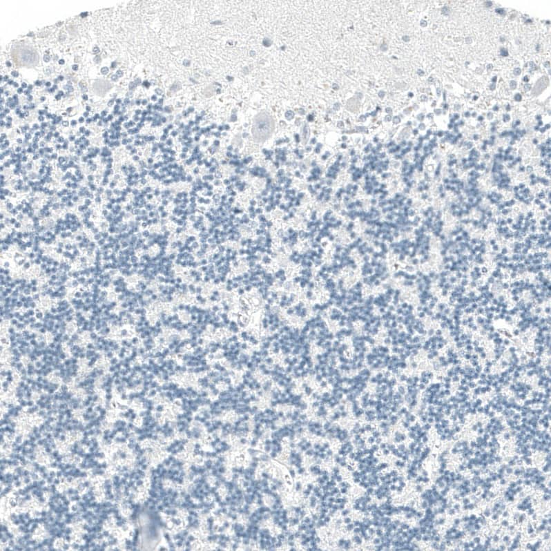 Staining of human cerebellum shows no positivity in Purkinje cells as expected.