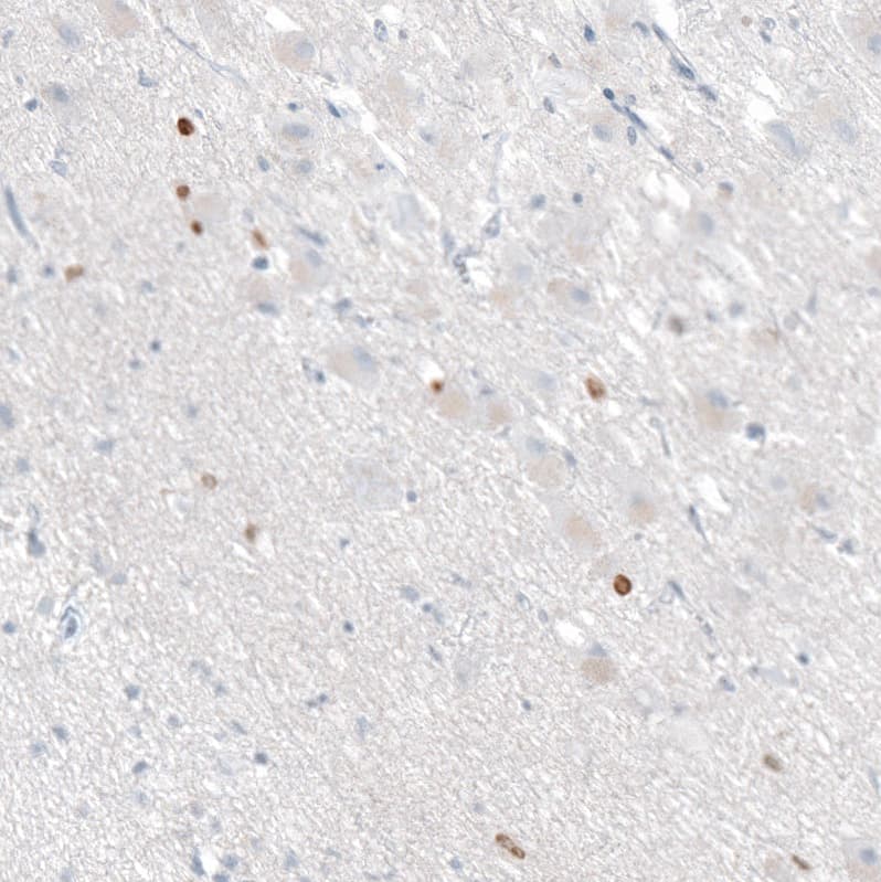 Staining of human hypothalamus shows moderate to strong nuclear positivity in a subset of neurons.