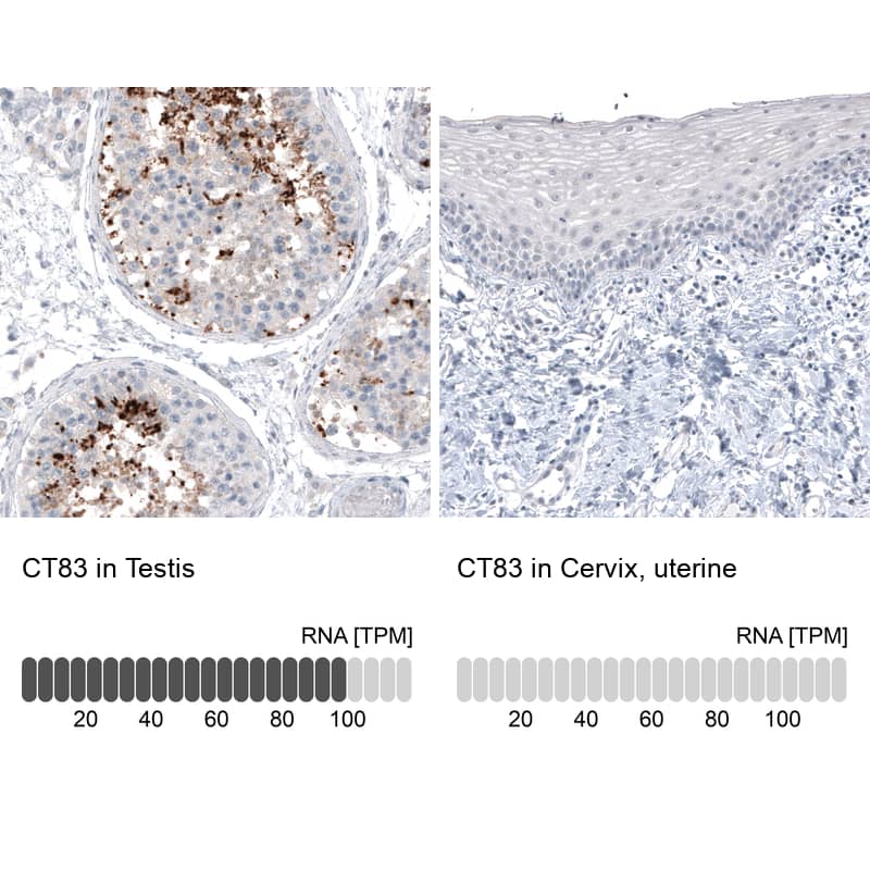 Analysis in human testis and cervix, uterine tissues. Corresponding CT83 RNA-seq data are presented for the same tissues.