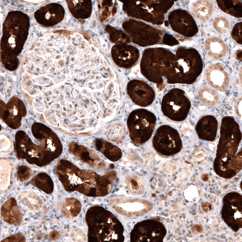 Staining of human kidney shows strong cytoplasmic positivity in cells in tubules.