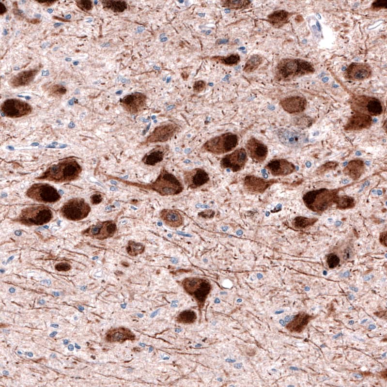 Staining of human substantia nigra shows cytoplasmic positivity in dopamine neurons in pars compacta.