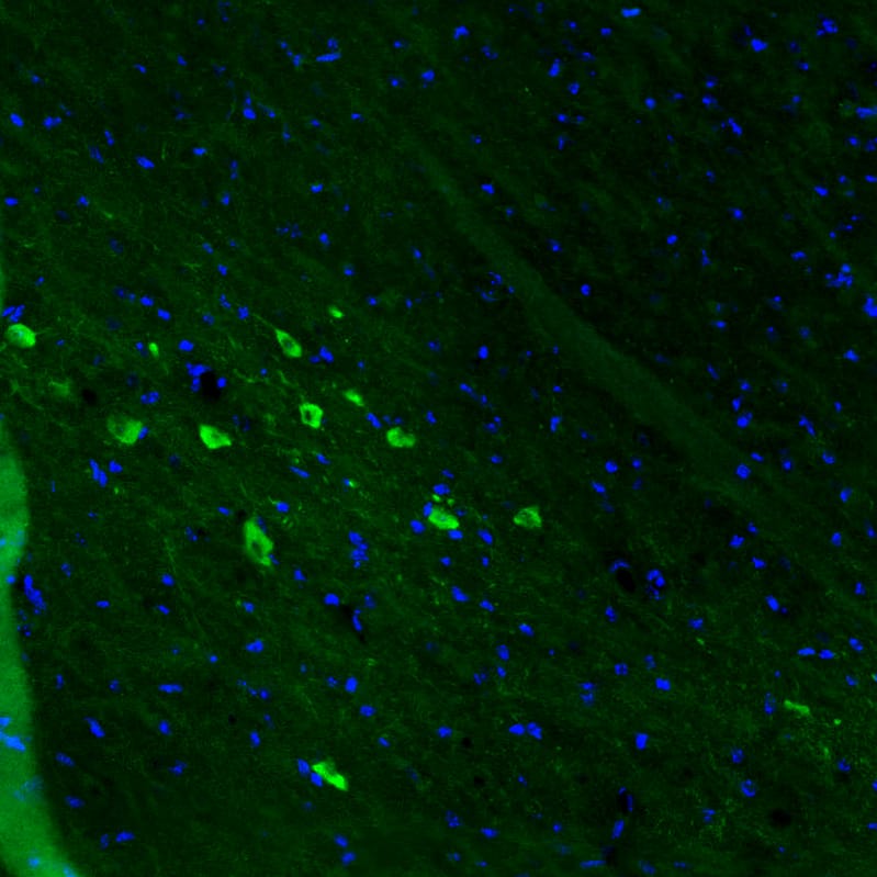 Staining of mouse substantia nigra shows strong positivity in dopamine neurons in pars compacta.