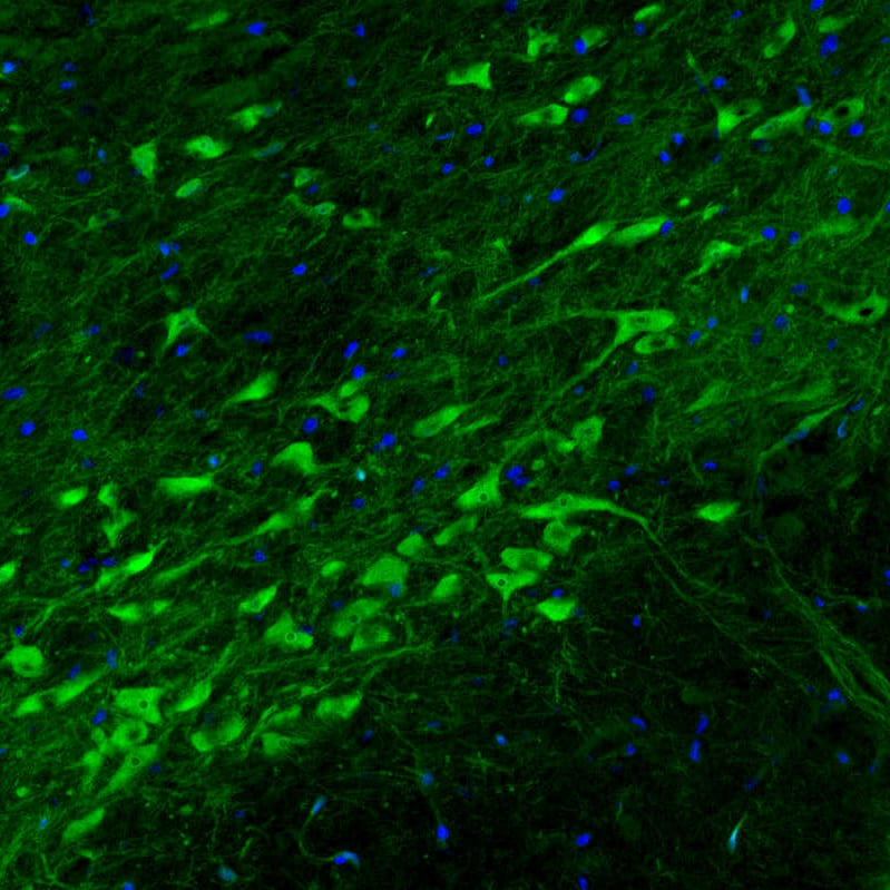 Staining of rat substantia nigra shows strong positivity in dopamine neurons in pars compacta.