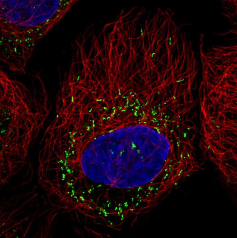 Staining in A431 cell line  showing specific staining of peroxisomes in green. Microtubule- and nuclear probes are visualized in red and blue respectively (where available).