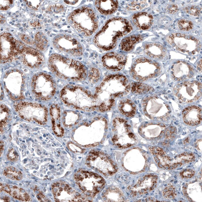 Staining of human kidney shows moderate granular cytoplasmic positivity in cells in tubules.
